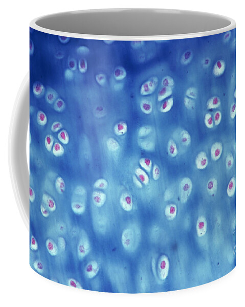 Articular Cartilage Coffee Mug featuring the photograph Hyaline Cartilage by M. I. Walker