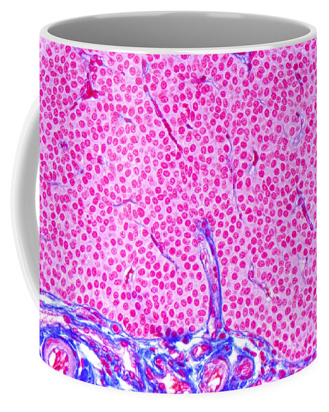Parathyroid Gland Coffee Mug featuring the photograph Parathyroid Gland Ts by M I Walker