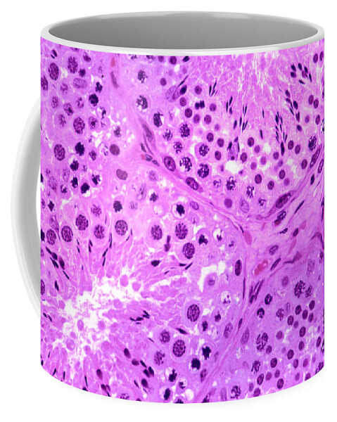 Light Microscopy Coffee Mug featuring the photograph Primate Testis by M. I. Walker