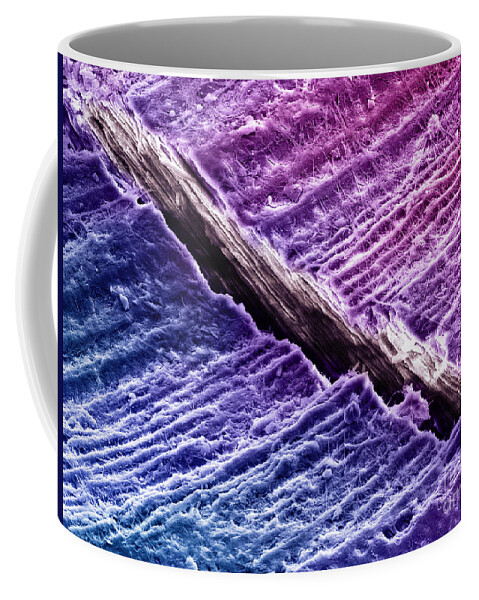Dentine Coffee Mug featuring the photograph Human Tooth Dentine, Sem #4 by Ted Kinsman