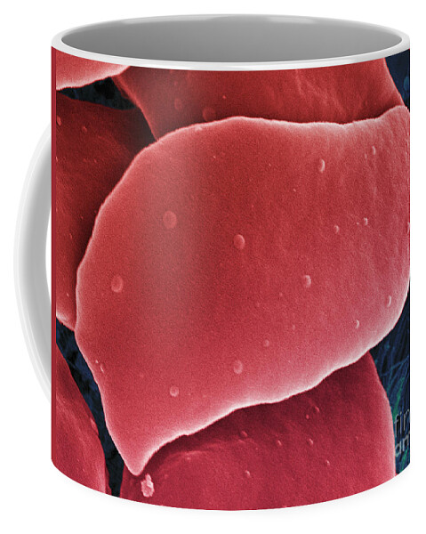 Science Coffee Mug featuring the photograph Blood Platelets, Sem #2 by Ted Kinsman