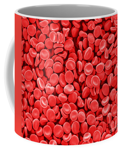 Red Blood Cells Coffee Mug featuring the photograph Red Blood Cells, Sem by Scimat