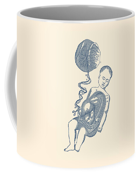 Fetal Circulatory System Coffee Mug featuring the drawing Baby and Placenta - Placenta Removal - Vintage Anatomy by Vintage Anatomy Prints