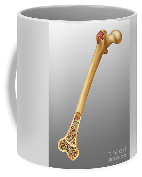 Science Coffee Mug featuring the photograph Bone Marrow And Tissue, Illustration by Gwen Shockey