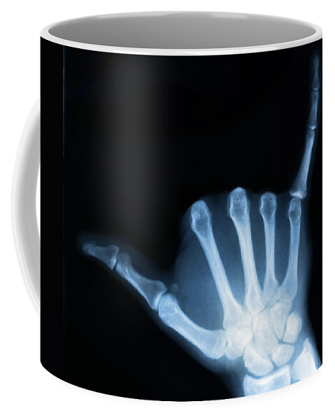 X-ray Coffee Mug featuring the photograph Hang Loose by Gravityx9 Designs