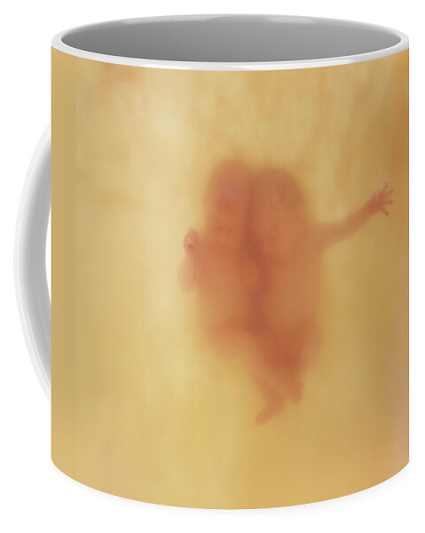 Babies Coffee Mug featuring the photograph Harry and Jack by Anne Geddes