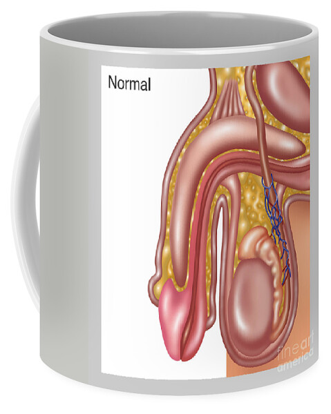 Medical Coffee Mug featuring the photograph Normal Scrotum Veins, Illustration by Gwen Shockey