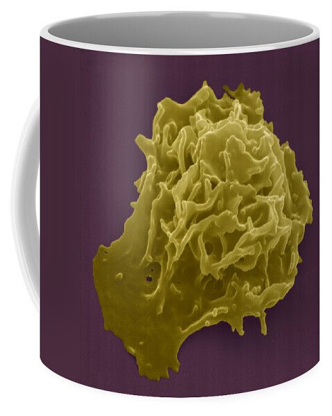 Antigen Coffee Mug featuring the photograph Killer Cell #1 by Meckes/ottawa