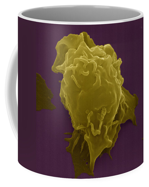 Antigen Coffee Mug featuring the photograph Killer Cell #4 by Meckes/ottawa