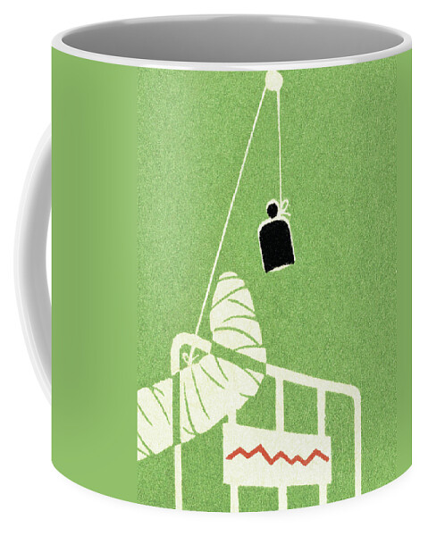Accident Coffee Mug featuring the drawing Broken Leg in Traction by CSA Images