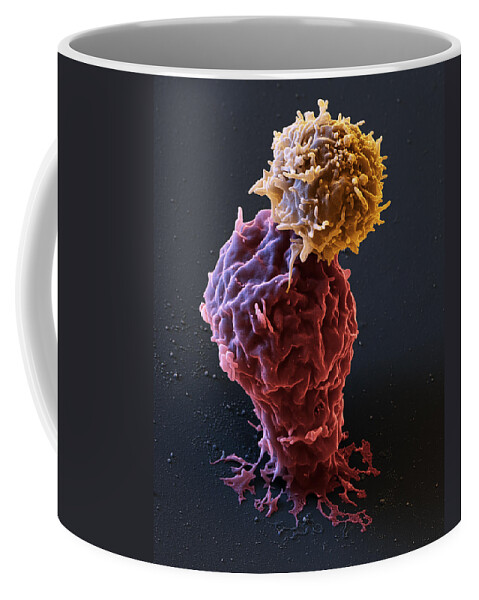 Attacks Leukemia Coffee Mug featuring the photograph Leukemia Cell With Car T-cell, Sem by Eye of Science