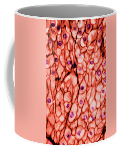 https://render.fineartamerica.com/images/rendered/default/frontright/mug/images/artworkimages/medium/2/smooth-muscle-tissue-transverse-don-fawcett.jpg?&targetx=293&targety=0&imagewidth=214&imageheight=333&modelwidth=800&modelheight=333&backgroundcolor=F3A99D&orientation=0&producttype=coffeemug-11