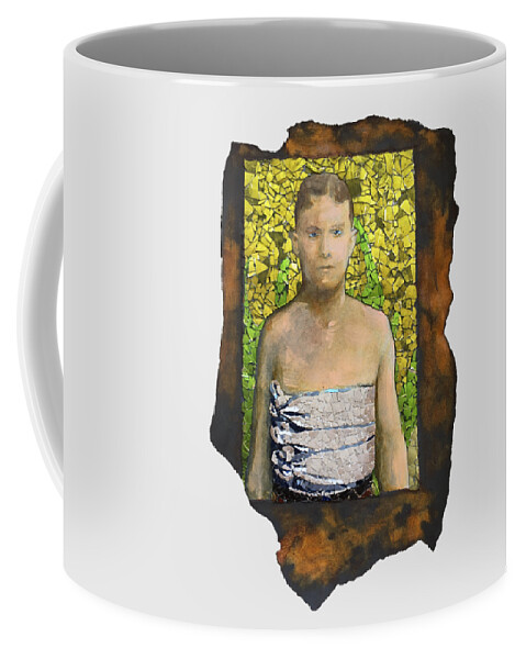 Glass Coffee Mug featuring the mixed media Fig. 69. Fractured ribs. by Matthew Lazure