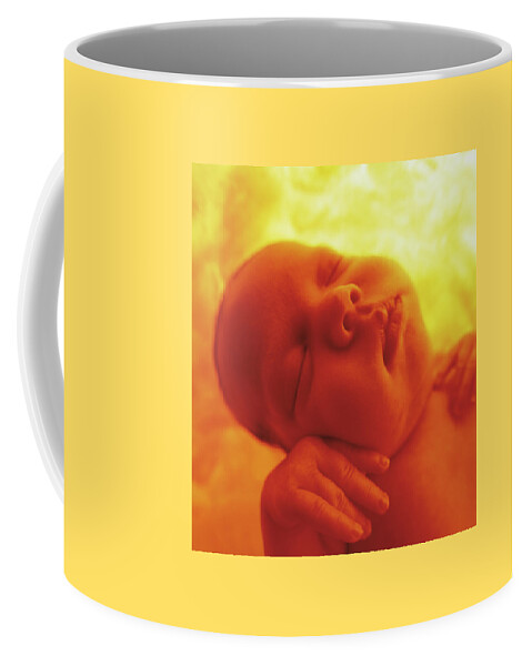 Colour Coffee Mug featuring the photograph Womb Series #2 by Anne Geddes