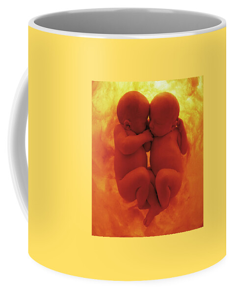 Color Coffee Mug featuring the photograph Womb Series #3 by Anne Geddes