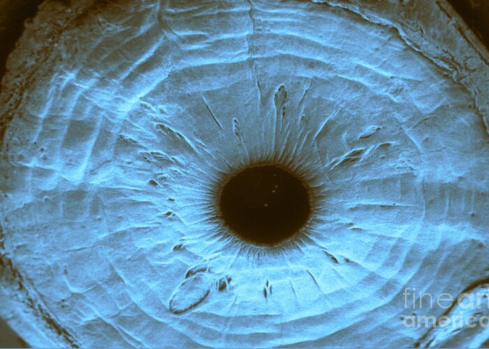 Anterior Segment Greeting Card featuring the photograph Anterior Surface Of Iris, Sem #1 by Ralph C. Eagle, Jr.