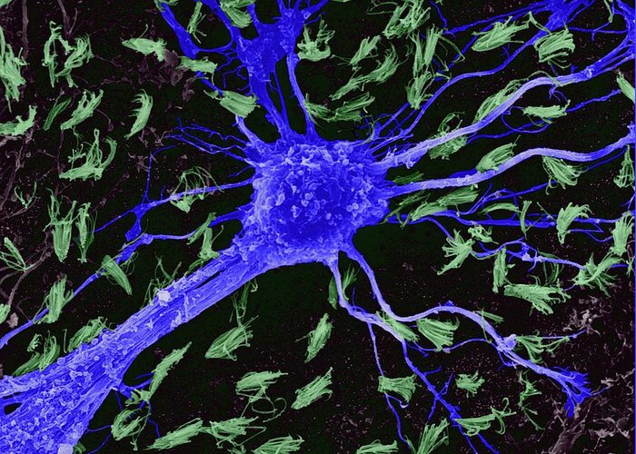 Astrocyte Greeting Card featuring the photograph Astrocytic Glial Cell From Cns #1 by Dennis Kunkel Microscopy/science Photo Library