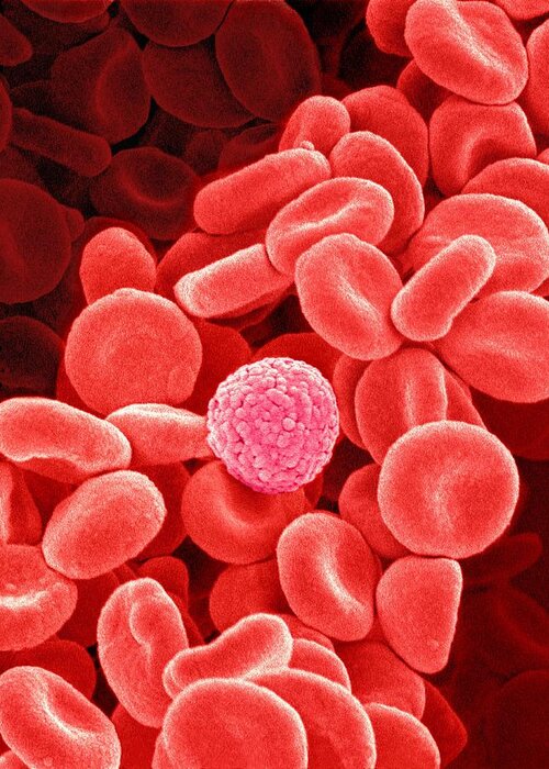 White Blood Cell Greeting Card featuring the photograph Blood cells, SEM #1 by Science Photo Library