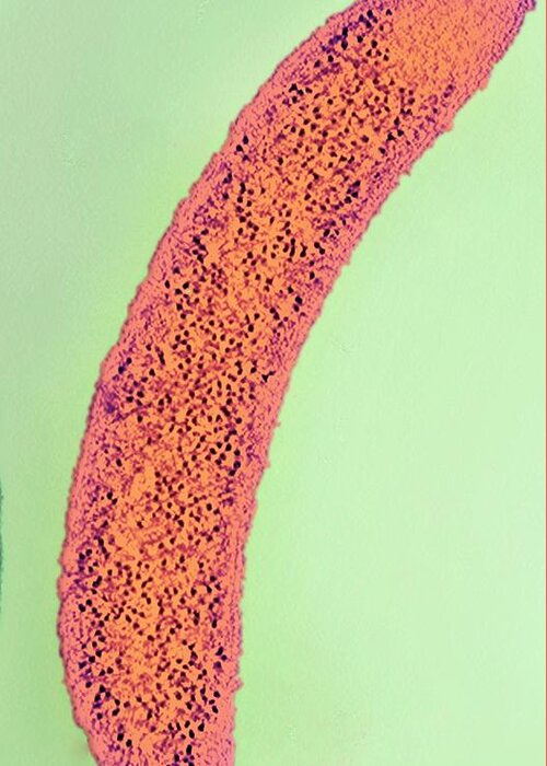 Caulobacter Crescentus Greeting Card featuring the photograph Caulobacter Crescentus Bacterium #1 by Ami Images