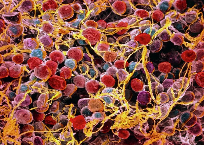 Magnified Image Greeting Card featuring the photograph Coloured Sem Of Adipose Tissue Showing Fat Cells #1 by Prof. P. Motta/dept. Of Anatomy/university \la Sapienza\, Rome/science Photo Library