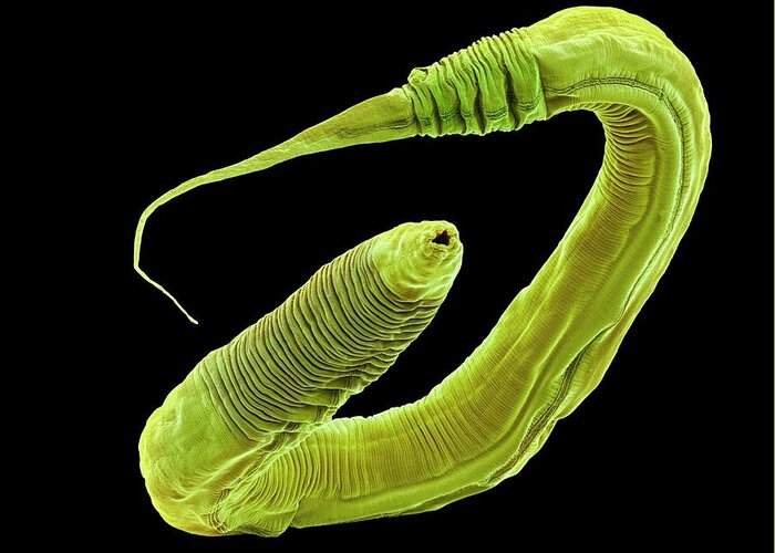 Caenorhabditis Elegans Greeting Card featuring the photograph C. Elegans Worm #16 by Steve Gschmeissner