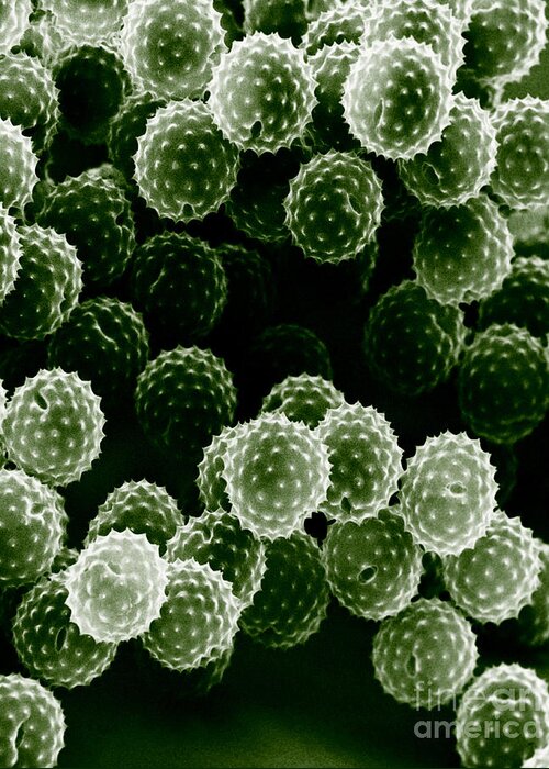 Allergen Greeting Card featuring the photograph Ragweed Pollen Sem by David M. Phillips / The Population Council