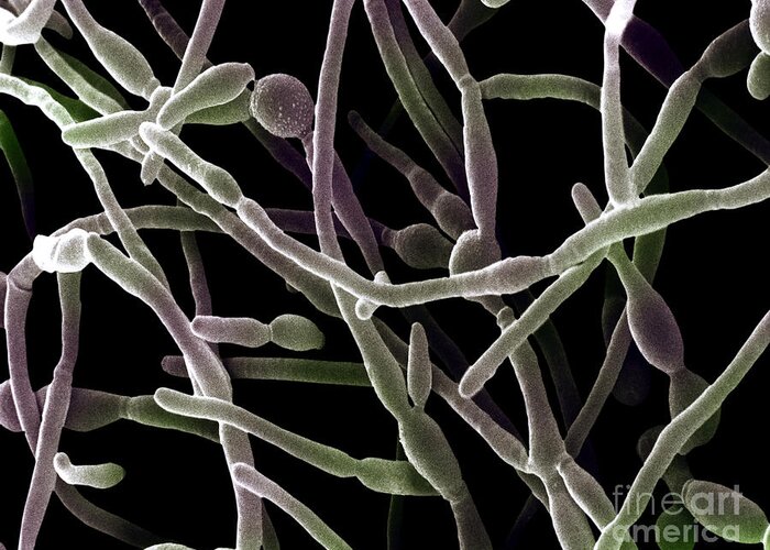Sem Greeting Card featuring the photograph Scanning Electron Micrograph Of Candida #2 by David M. Phillips