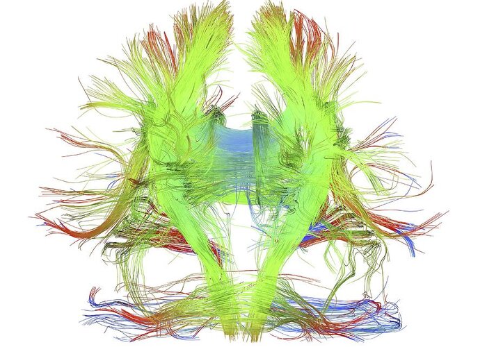 Brain Scan Greeting Card featuring the photograph White Matter Fibres Of The Human Brain #21 by Alfred Pasieka