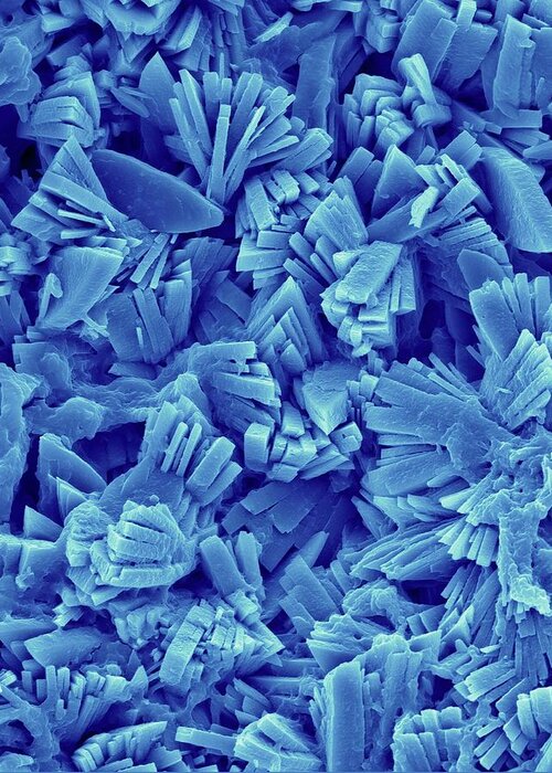 24010d Greeting Card featuring the photograph Kidney Stone Monoclinic Crystals #3 by Dennis Kunkel Microscopy/science Photo Library