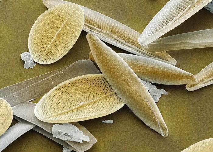 Navicula Sp. Greeting Card featuring the photograph Diatoms, Sem #4 by Power And Syred