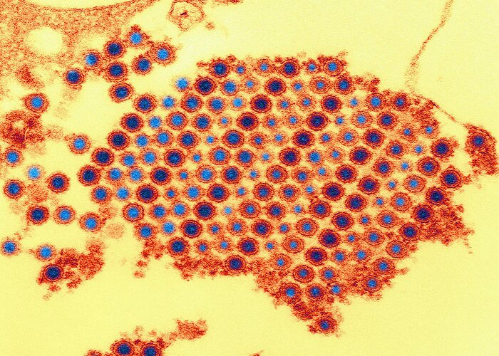 Chikungunya Greeting Card featuring the photograph Tem Of Chikungunya Virus #4 by Science Source
