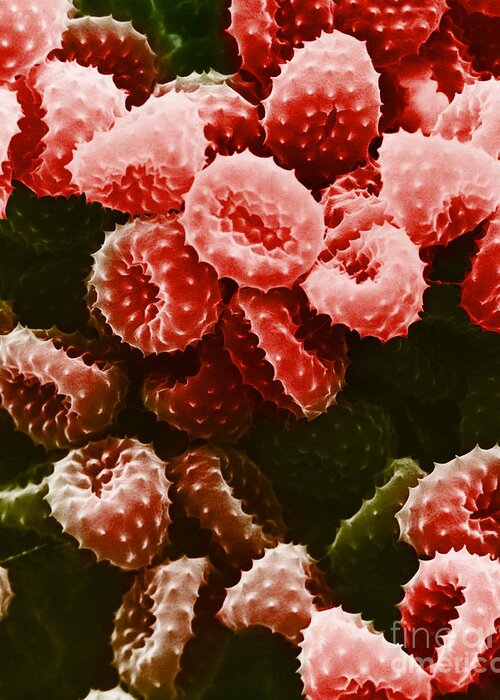 Allergen Greeting Card featuring the photograph Ragweed Pollen Sem #6 by David M. Phillips / The Population Council