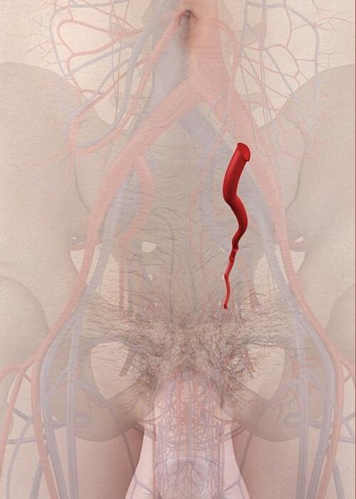 Artwork Greeting Card featuring the photograph Human Artery #8 by Sciepro