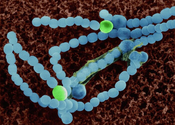 Nostocales Greeting Card featuring the photograph Cyanobacterium (anabaena Sp.) by Dennis Kunkel Microscopy/science Photo Library