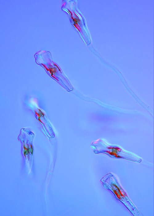 Aquatic Greeting Card featuring the photograph Gomphonema Diatoms by Marek Mis
