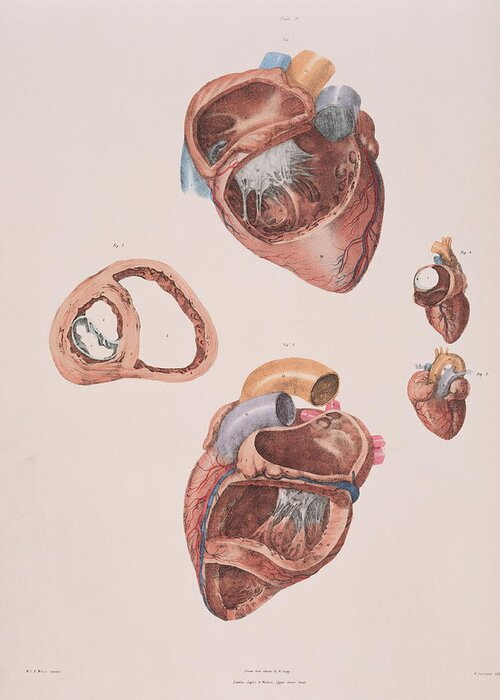 19th Century Greeting Card featuring the photograph Heart Chambers by Sheila Terry/science Photo Library
