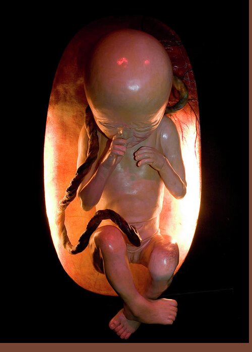 Human Greeting Card featuring the photograph Human Foetus by Natural History Museum, London/science Photo Library