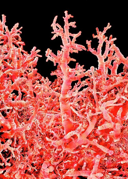 Villus Greeting Card featuring the photograph Lung Blood Vessels by Susumu Nishinaga