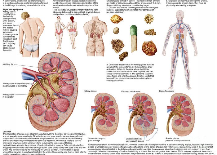Healthcare Greeting Card featuring the digital art Medical Chart Showing The Signs by Stocktrek Images