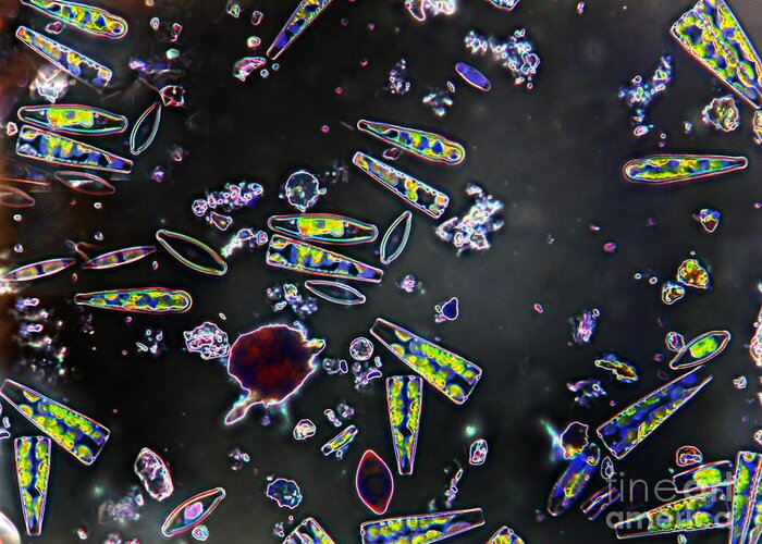 Diatom Greeting Card featuring the photograph Mixed Diatoms by Garry DeLong