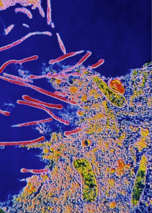 Mycoplasma Sp. Greeting Card featuring the photograph Mycoplasma Sp. Bacteria Infect Cell by Cnri/science Photo Library