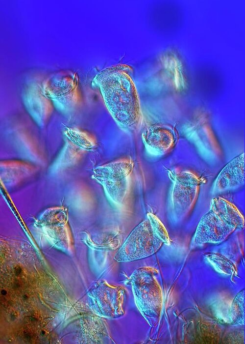 Aquatic Greeting Card featuring the photograph Vorticella Protozoa by Frank Fox