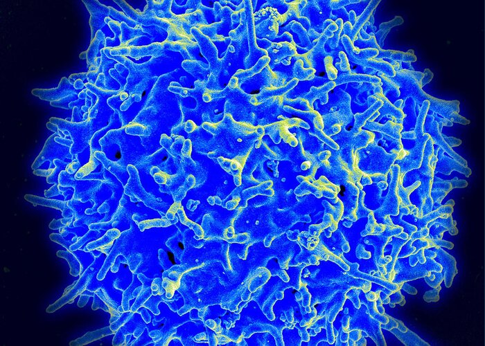 Biology Greeting Card featuring the photograph Healthy Human T Cell, Sem #1 by Science Source