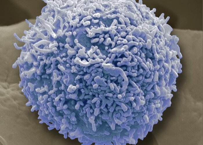Sem Greeting Card featuring the photograph Lymphocyte White Blood Cell, Sem #1 by Steve Gschmeissner