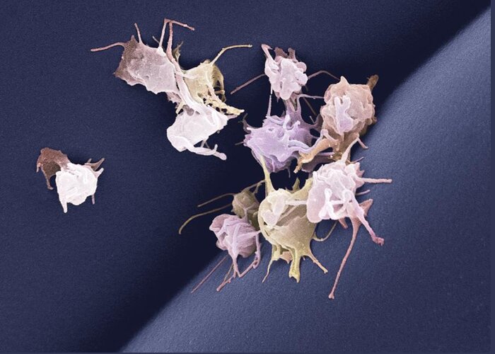 Thrombocyte Greeting Card featuring the photograph Activated Platelets, Sem #2 by Steve Gschmeissner