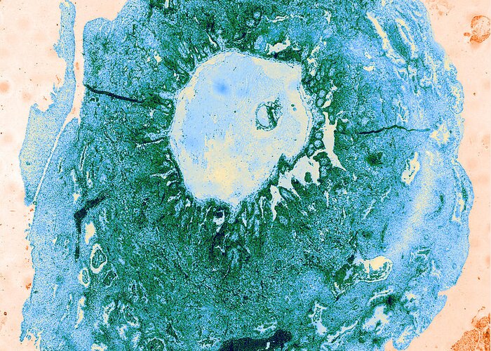 Fertilized Greeting Card featuring the photograph Tem Of Human Ovum #3 by Omikron