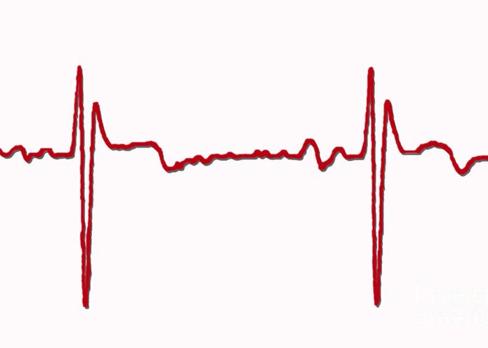 Ecg Greeting Card featuring the photograph Normal Ecg #6 by Science Source