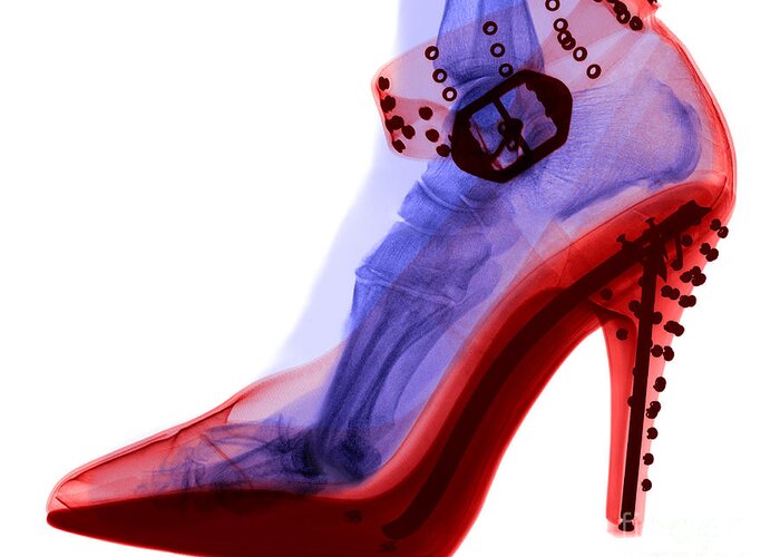 Shoe Greeting Card featuring the photograph An X-ray Of A Foot In A High Heel Shoe by Ted Kinsman