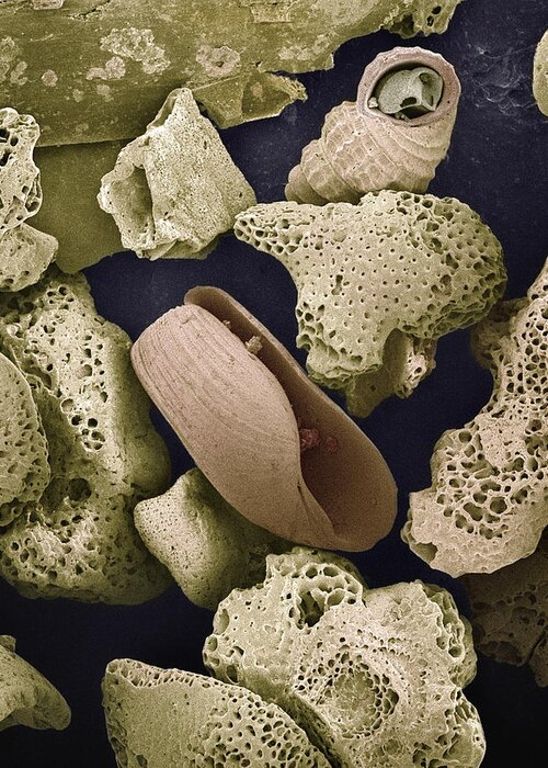 Mp Greeting Card featuring the photograph Foraminiferans Molluscs and Bryozoans SEM by Albert Lleal