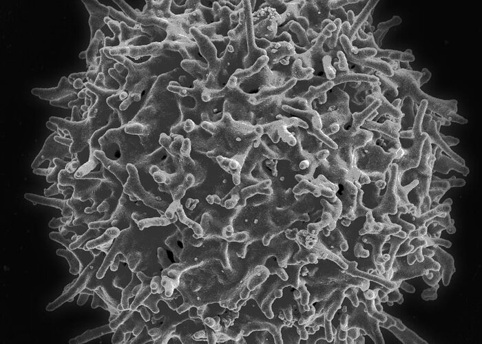Biology Greeting Card featuring the photograph Healthy Human T Cell, Sem by Science Source